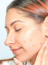 Skin Tint hydrocolloid Pimple Patches: Shade Light
